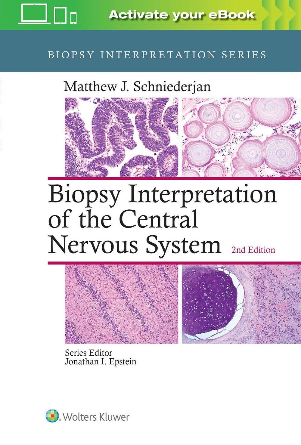 Biopsy Interpretation of the Central Nervous System, 2nd Edition, 9781496382634