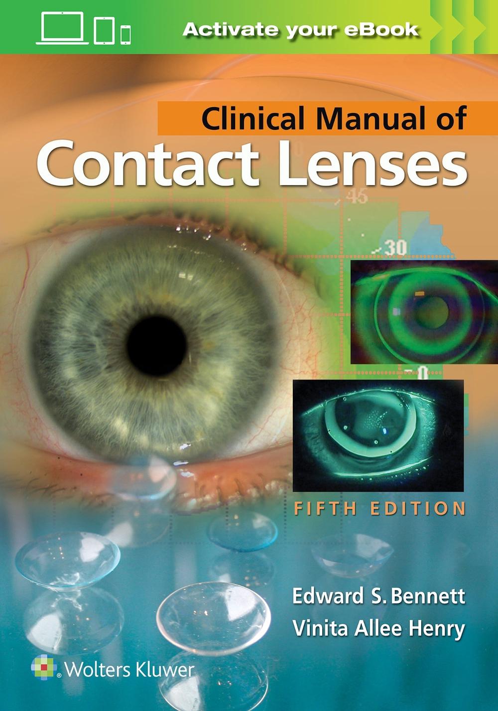 Clinical Manual of Contact Lenses, 9781496397799