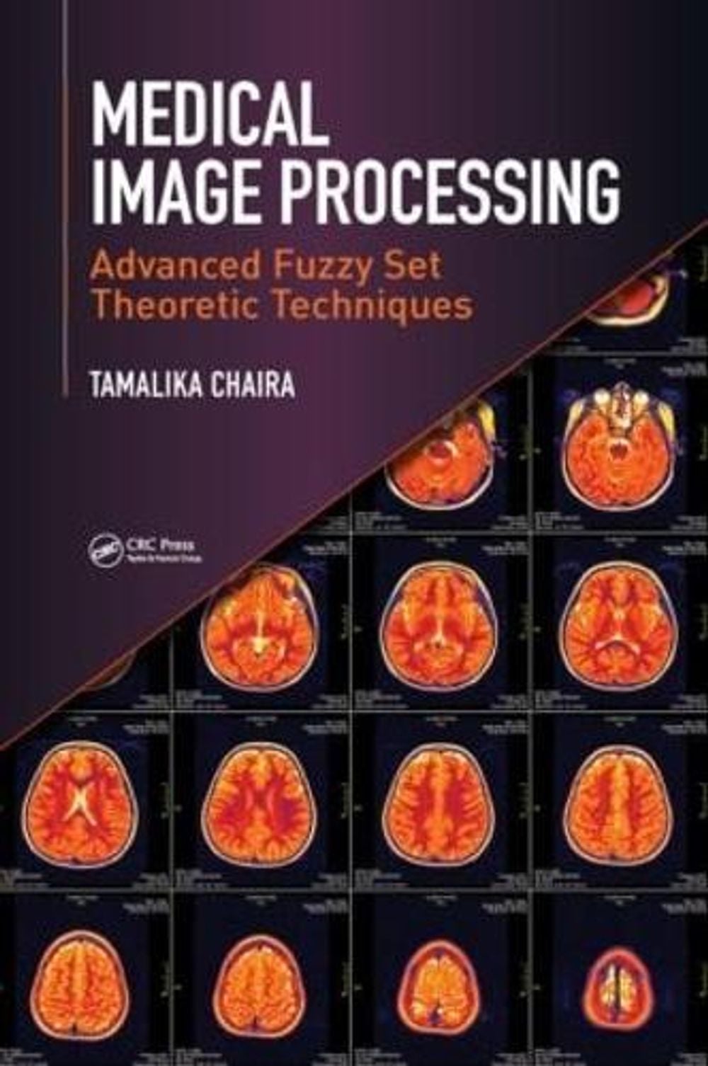 Medical Image Processing by Tamalika Chaira - ISBN: 9781498700450