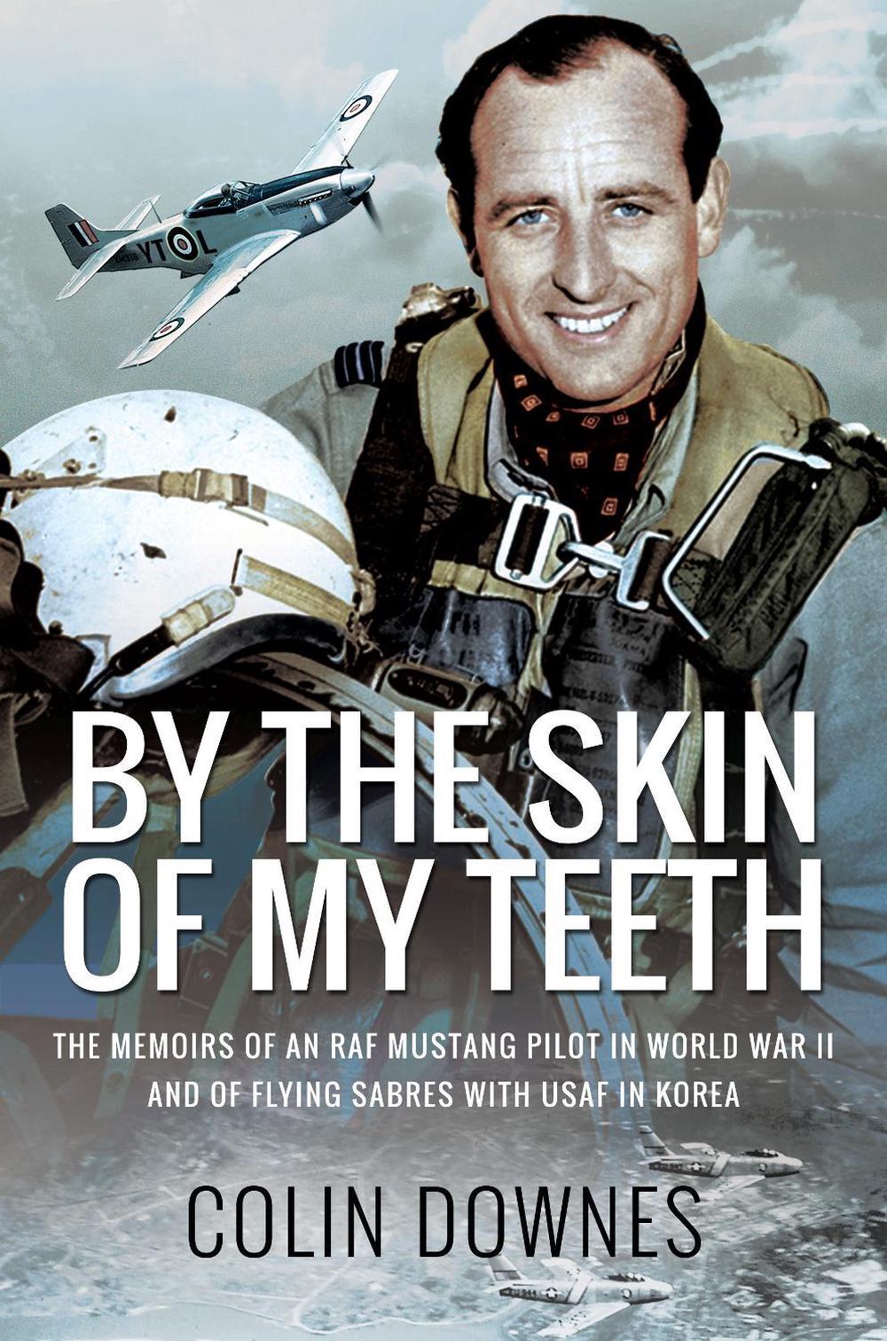 By the Skin of My Teeth by Colin Downes - ISBN: 9781526781642