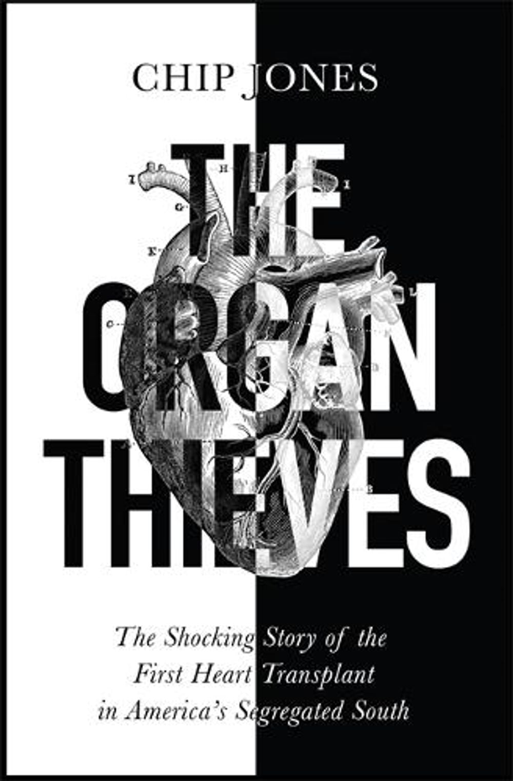 The Organ Thieves by Chip Jones - ISBN: 9781529400625