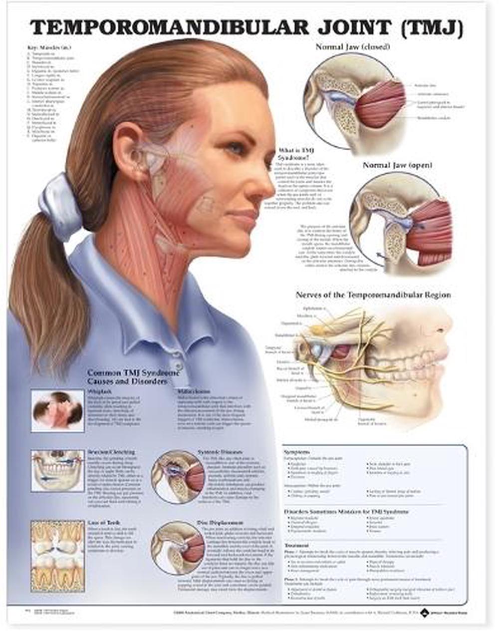 Temporomandibular Joint (TMJ) Anatomical Chart - Laminated by ...