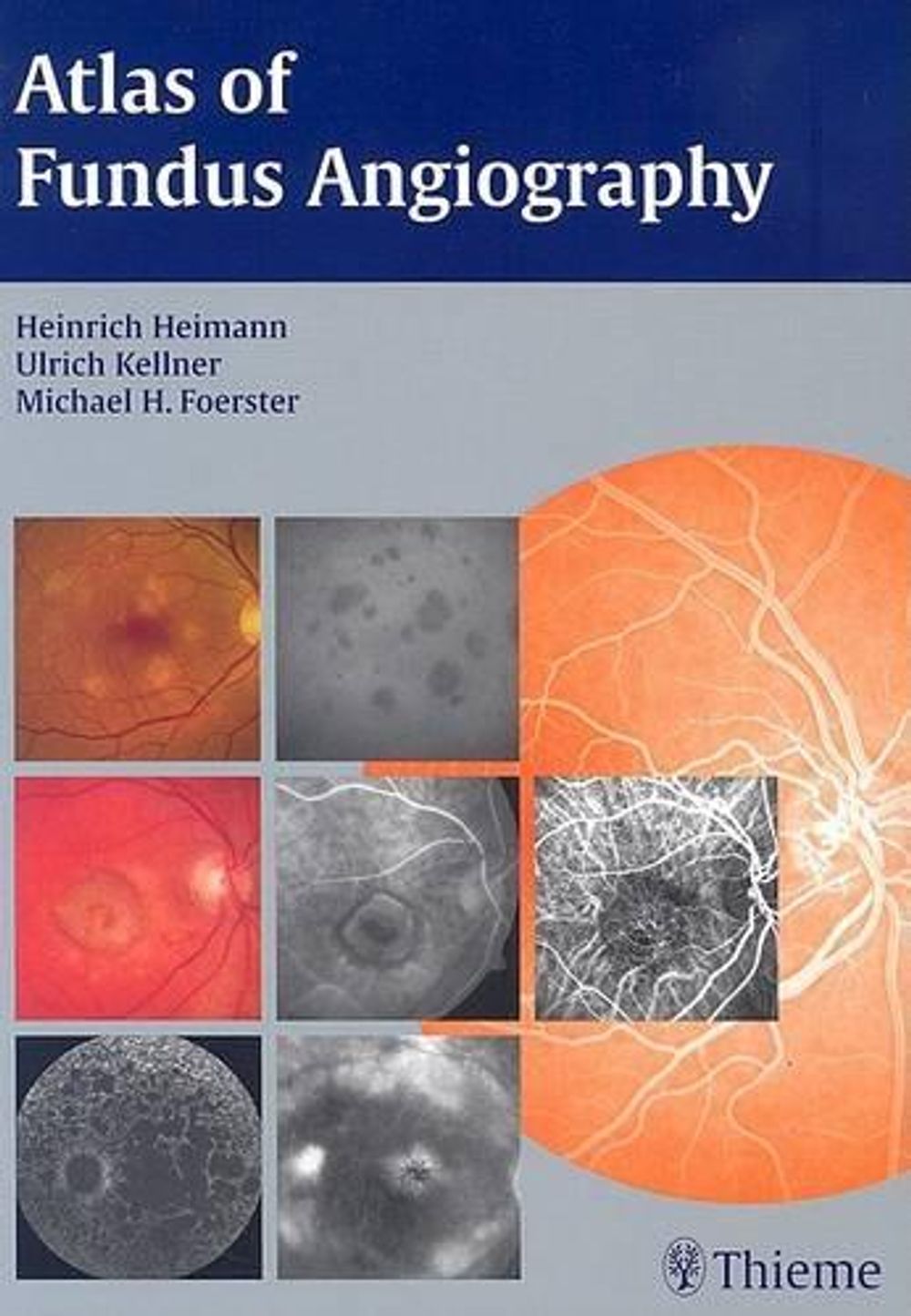 Atlas of Fundus Angiography by Heinrich Heimann - ISBN: 9781588904386