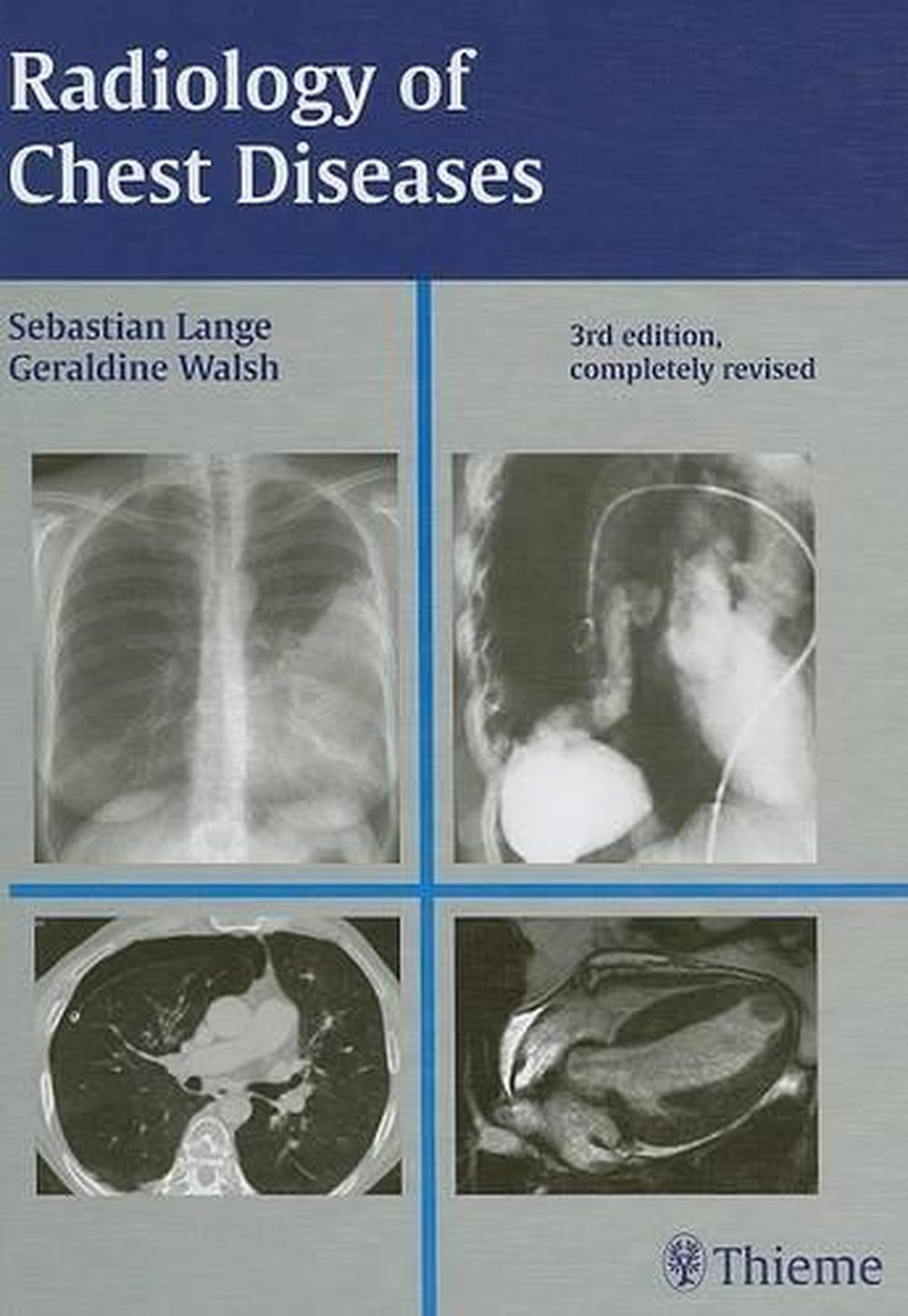 Radiology of Chest Diseases by Sebastian Lange - ISBN: 9781588904478