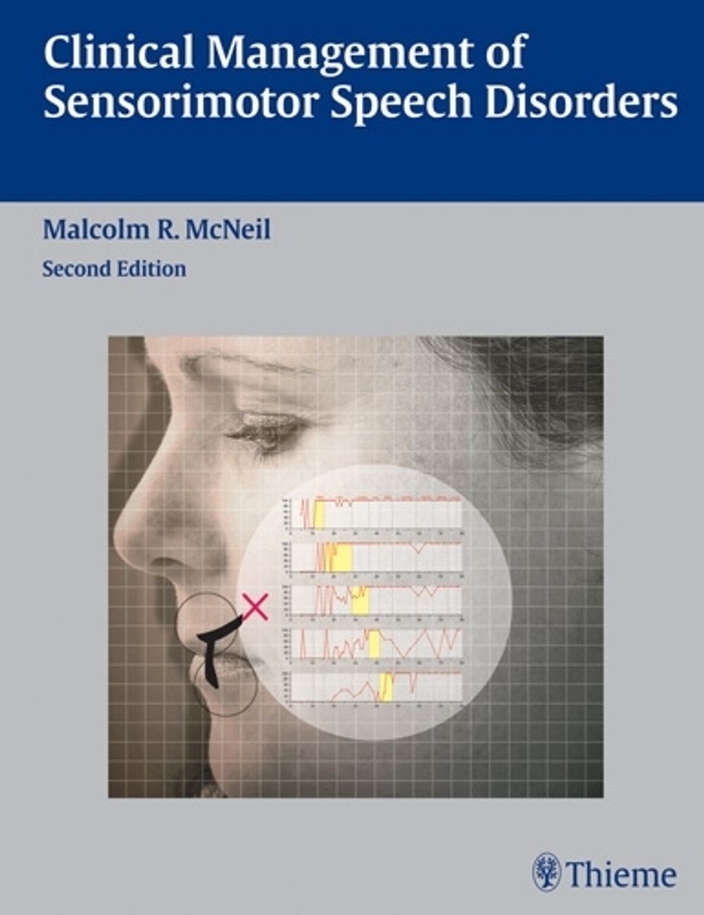 Clinical Management of Sensorimotor Speech Disorders by Malcolm R. McNeil - ISBN: 9781588905147