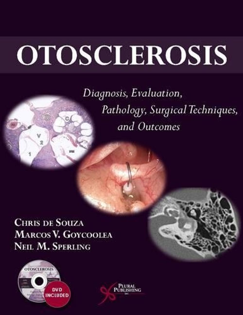 Otosclerosis by Chris De Souza - ISBN: 9781597565073