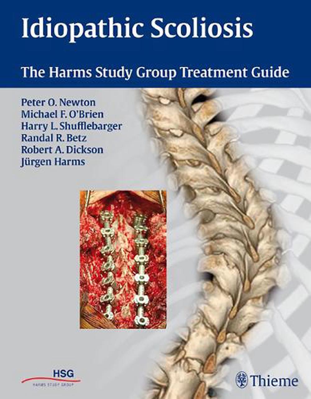 Idiopathic Scoliosis by Michael F. O'Brien - ISBN: 9781604060249