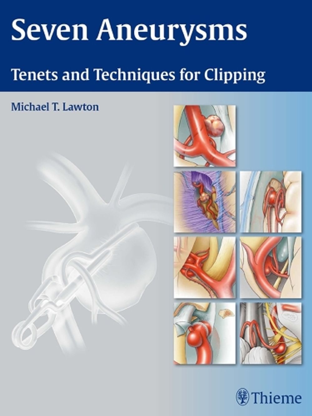Seven Aneurysms by Michael T. Lawton - ISBN: 9781604060546