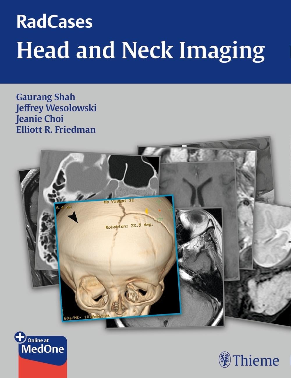 RadCases Head and Neck Imaging by Gaurang Shah - ISBN: 9781604061932