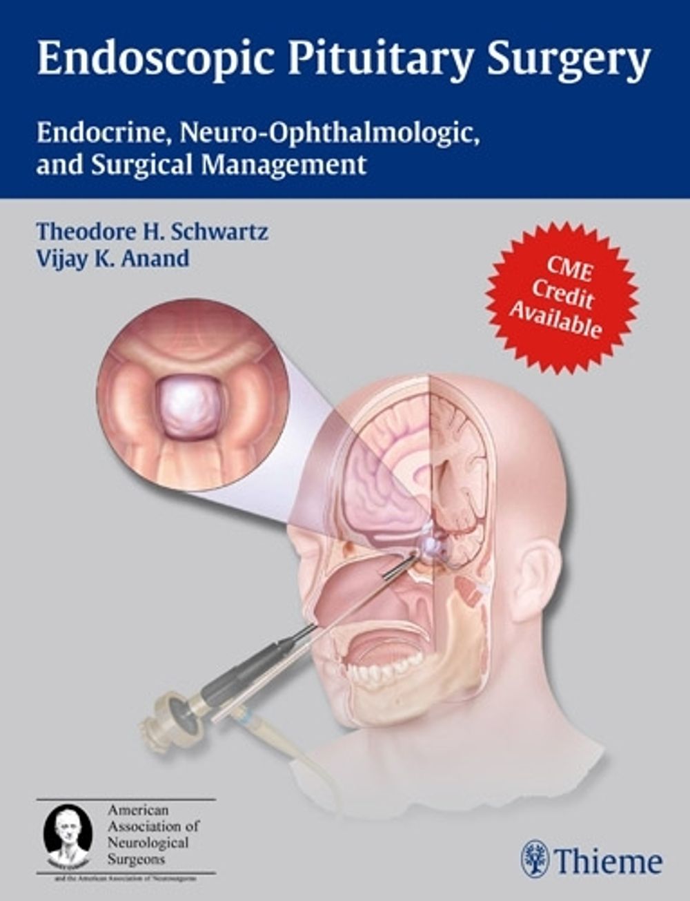 Endoscopic Pituitary Surgery by Theodore H. Schwartz - ISBN: 9781604063479