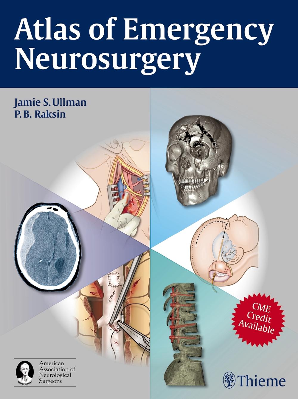 Atlas of Emergency Neurosurgery by Jamie S. Ullman - ISBN: 9781604063684