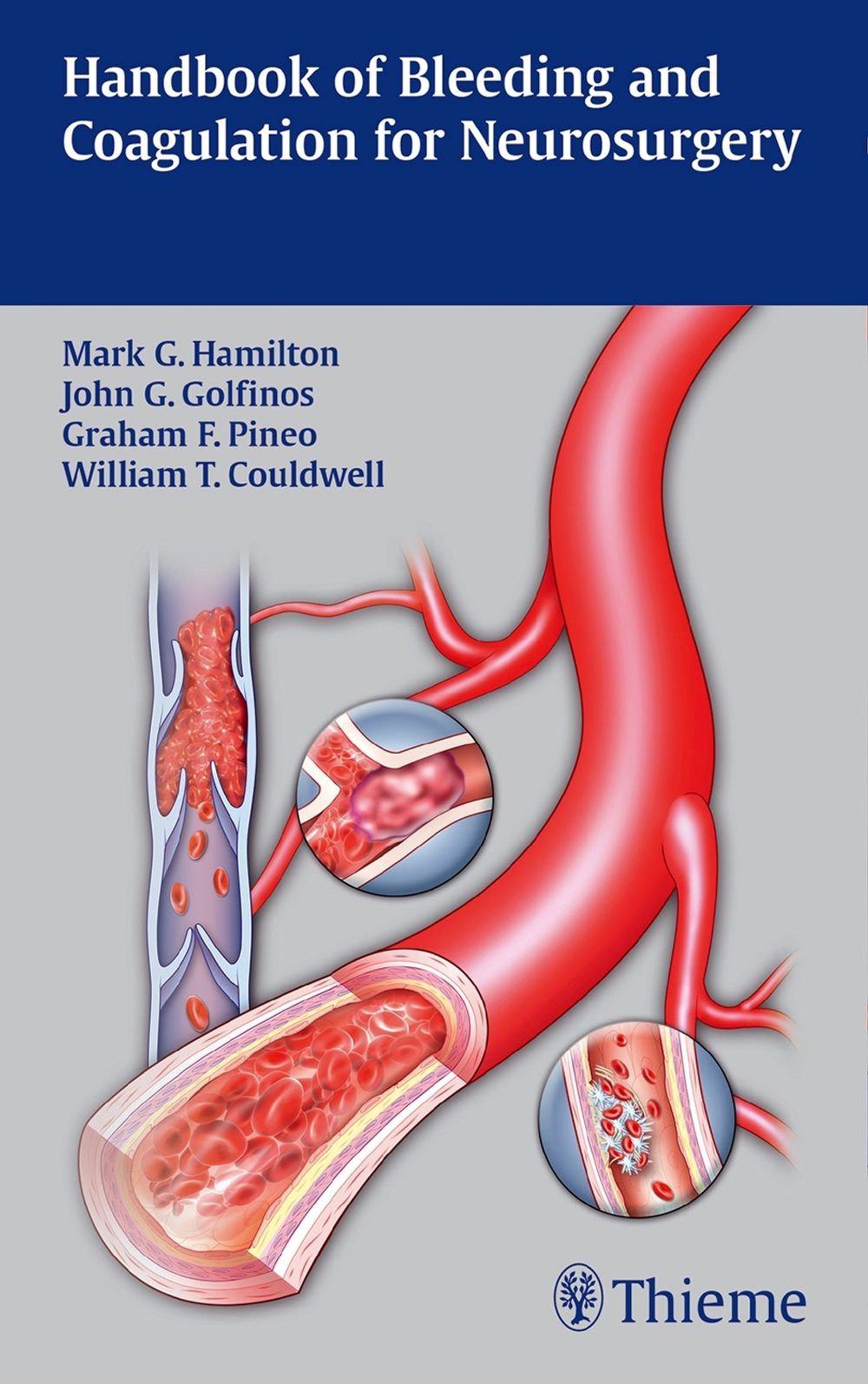 Handbook of Bleeding and Coagulation for Neurosurgery by Mark G. Hamilton - ISBN: 9781604065442