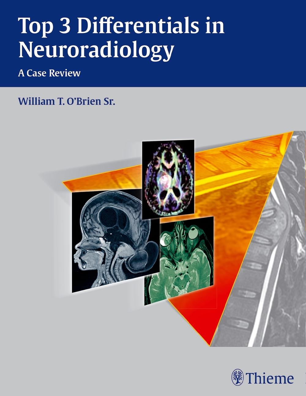 Top 3 Differentials in Neuroradiology by William T. O'Brien - ISBN: 9781604067231
