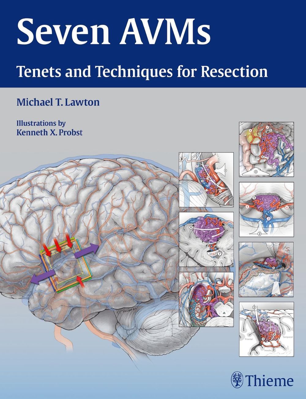 Seven AVMs by Michael T. Lawton - ISBN: 9781604068757