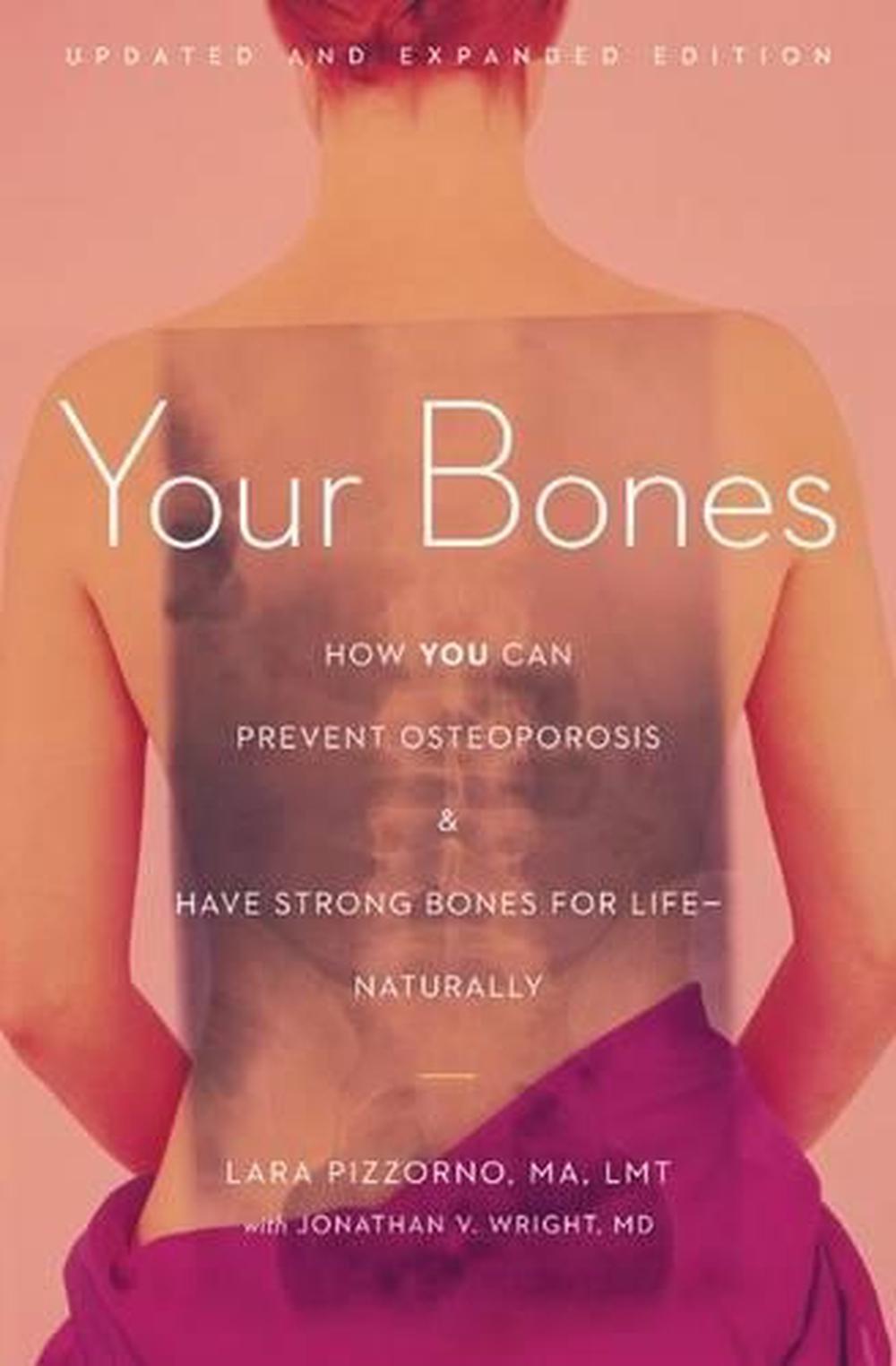Your Bones, 9781607660132