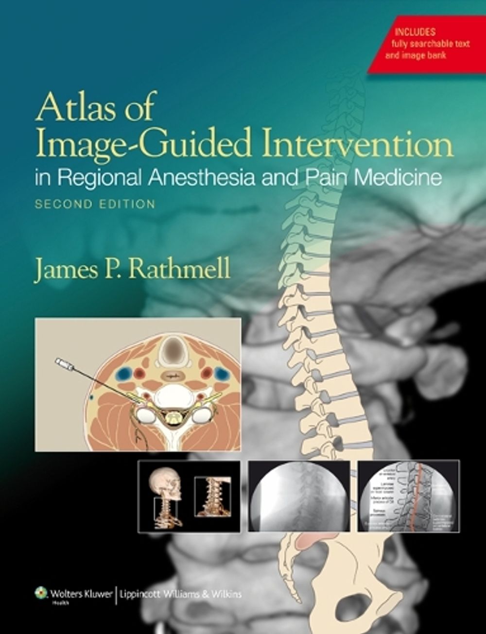 Atlas of Image-Guided Intervention in Regional Anesthesia and Pain Medicine, 2nd Edition by James P. Rathmell - ISBN: 9781608317042