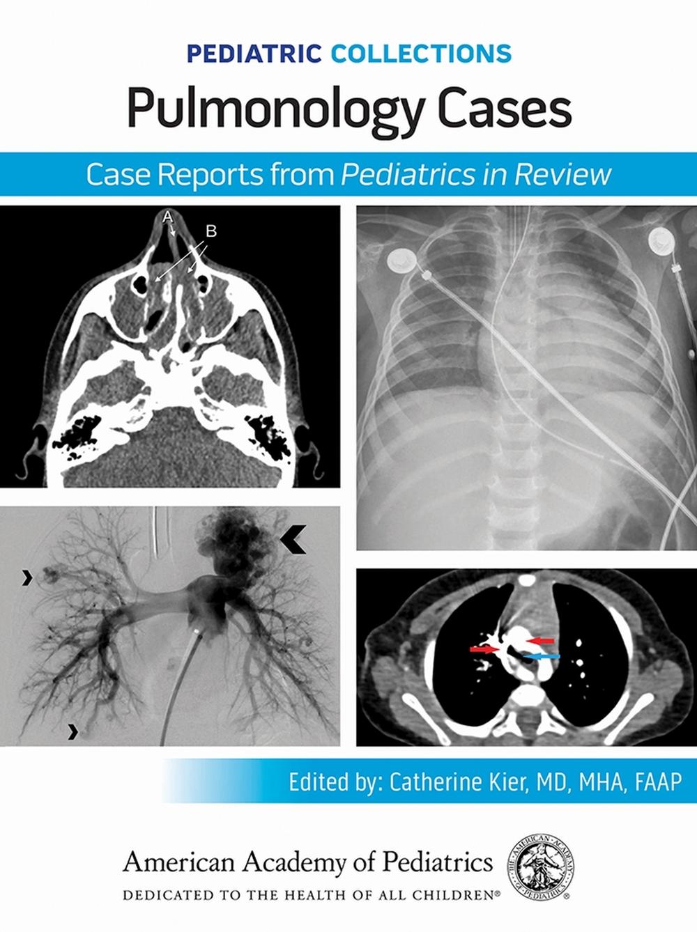 Pulmonology Cases, 9781610028165