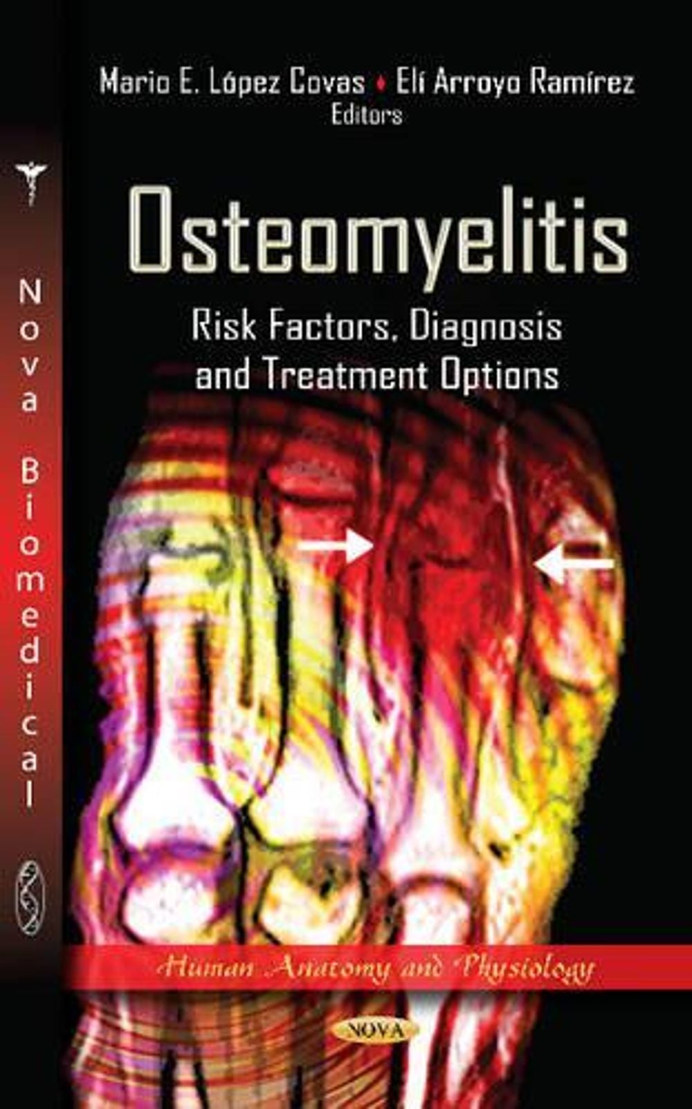 Osteomyelitis by Mario E. López Covas - ISBN: 9781619422926