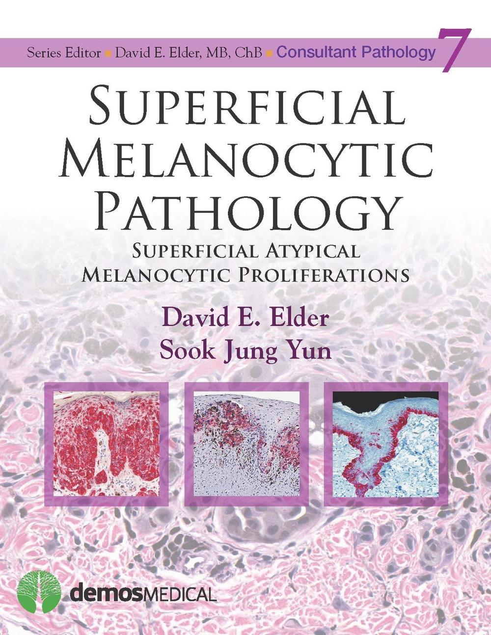 Superficial Melanocytic Pathology, 9781620700235