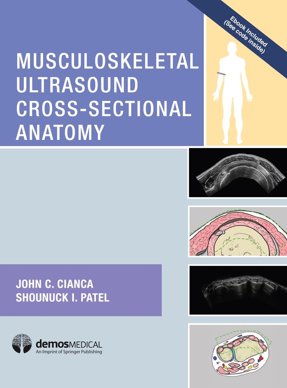 Musculoskeletal Ultrasound Cross-Sectional Anatomy, 9781620700624