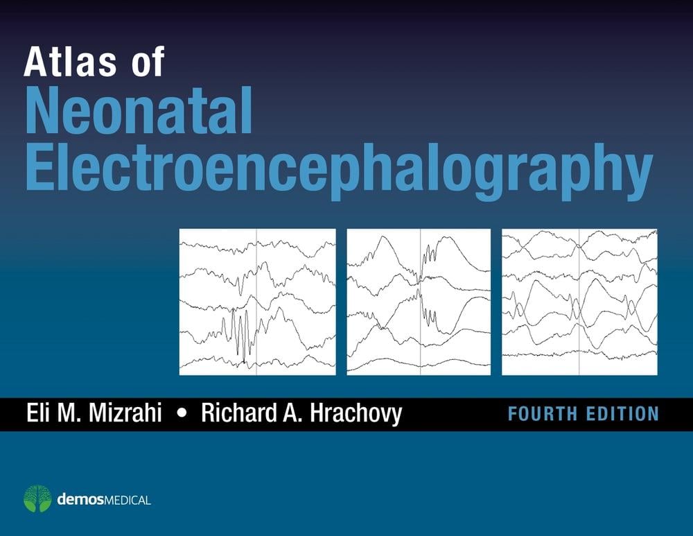 Atlas of Neonatal Electroencephalography by Eli M. Mizrahi - ISBN: 9781620700679