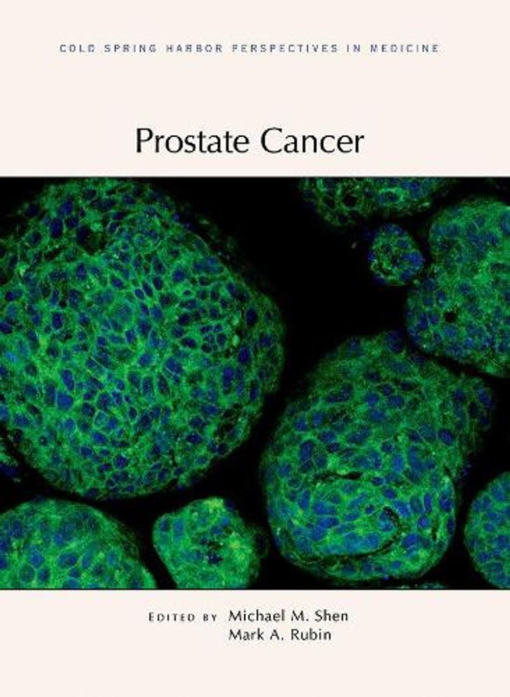 Prostate Cancer by Michael Shen - ISBN: 9781621821649