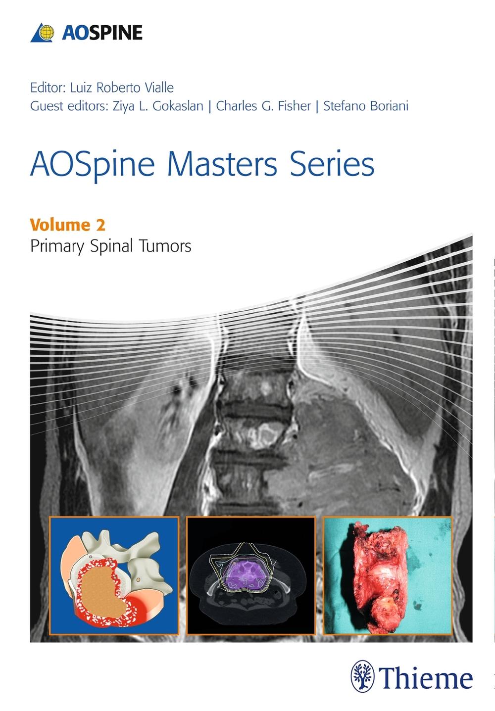 AOSpine Masters Series Volume 2: Primary Spinal Tumors, 9781626230477