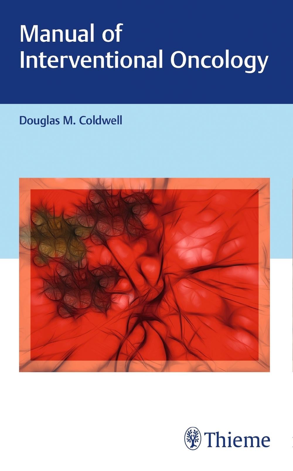 Manual of Interventional Oncology by Douglas M. Coldwell - ISBN: 9781626231382