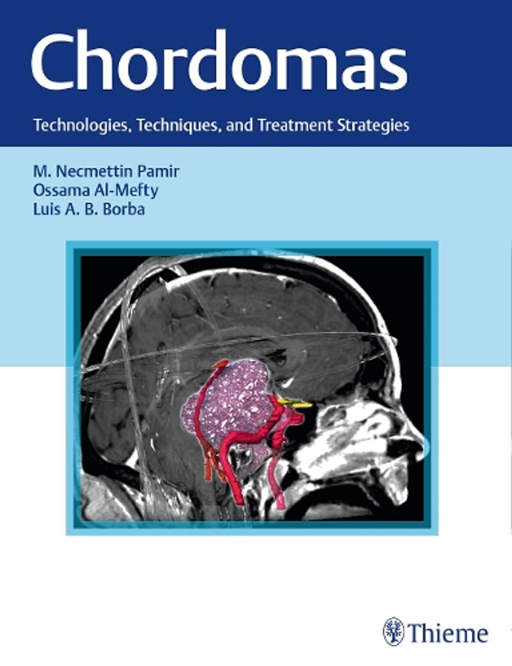 Chordomas by M. Necmettin Pamir - ISBN: 9781626231597