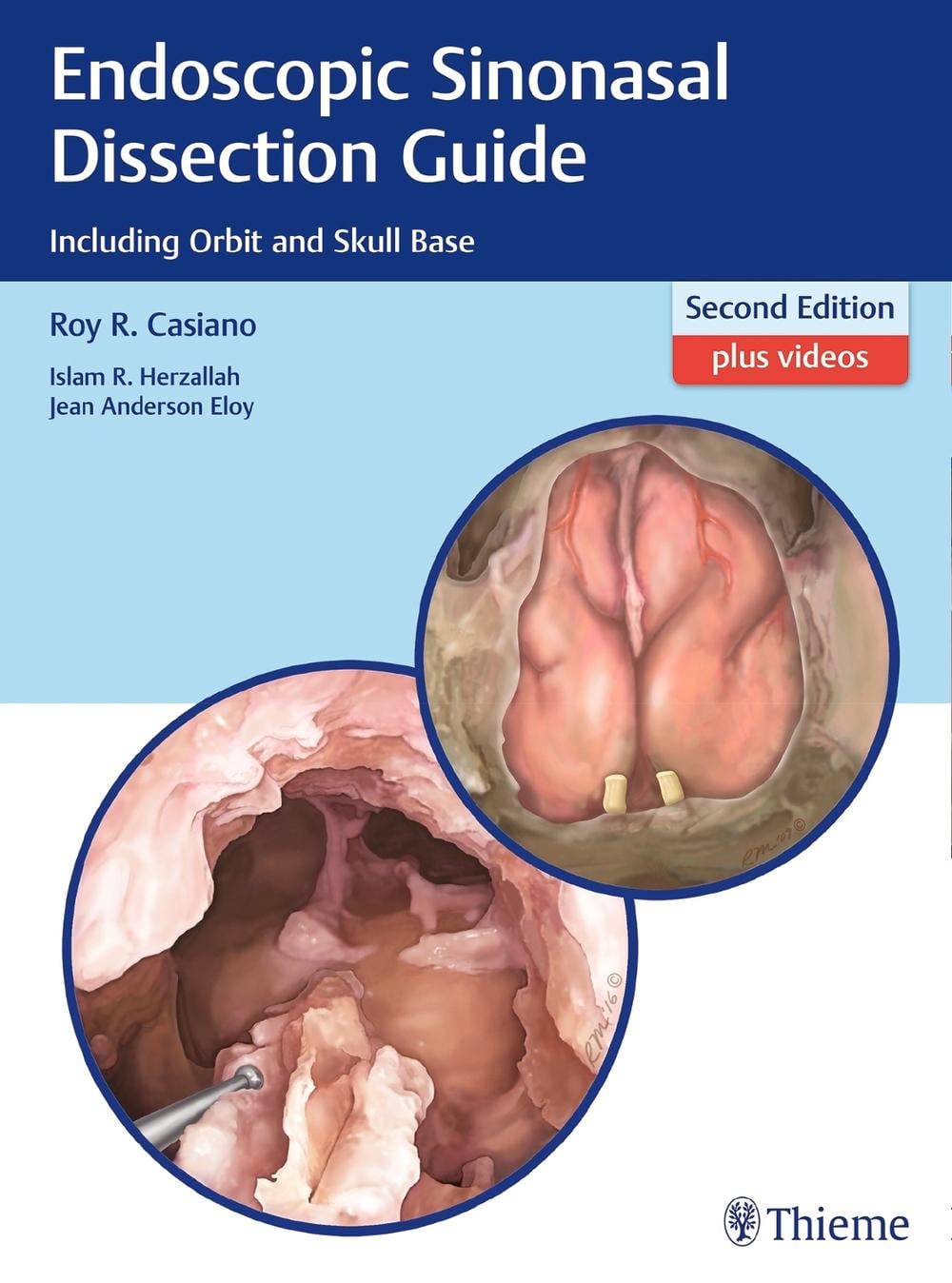Endoscopic Sinonasal Dissection Guide by Roy R. Casiano - ISBN: 9781626232105