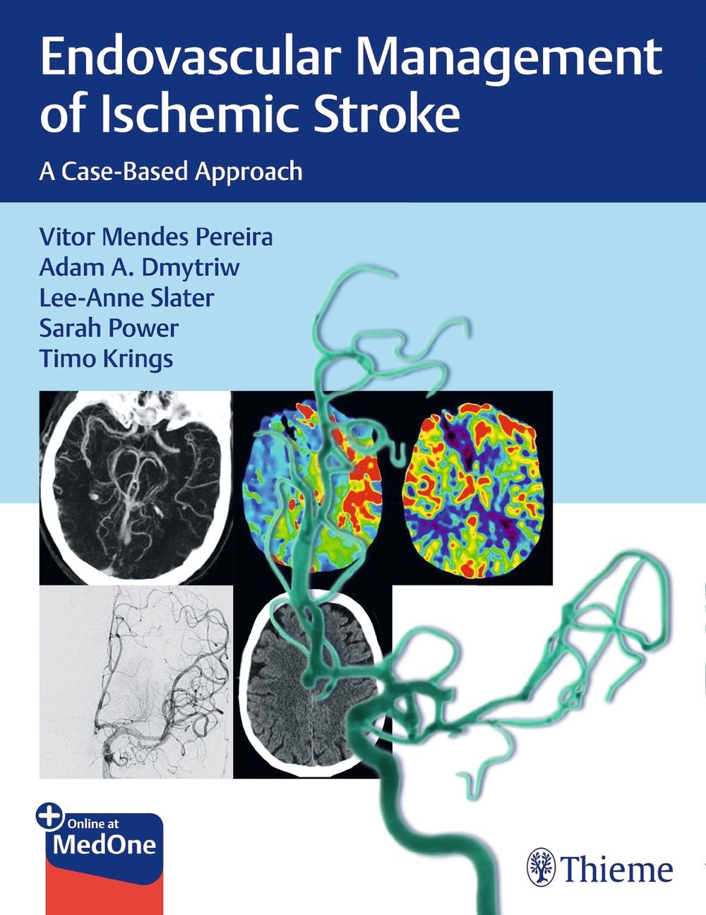 Endovascular Management of Ischemic Stroke, 9781626232754