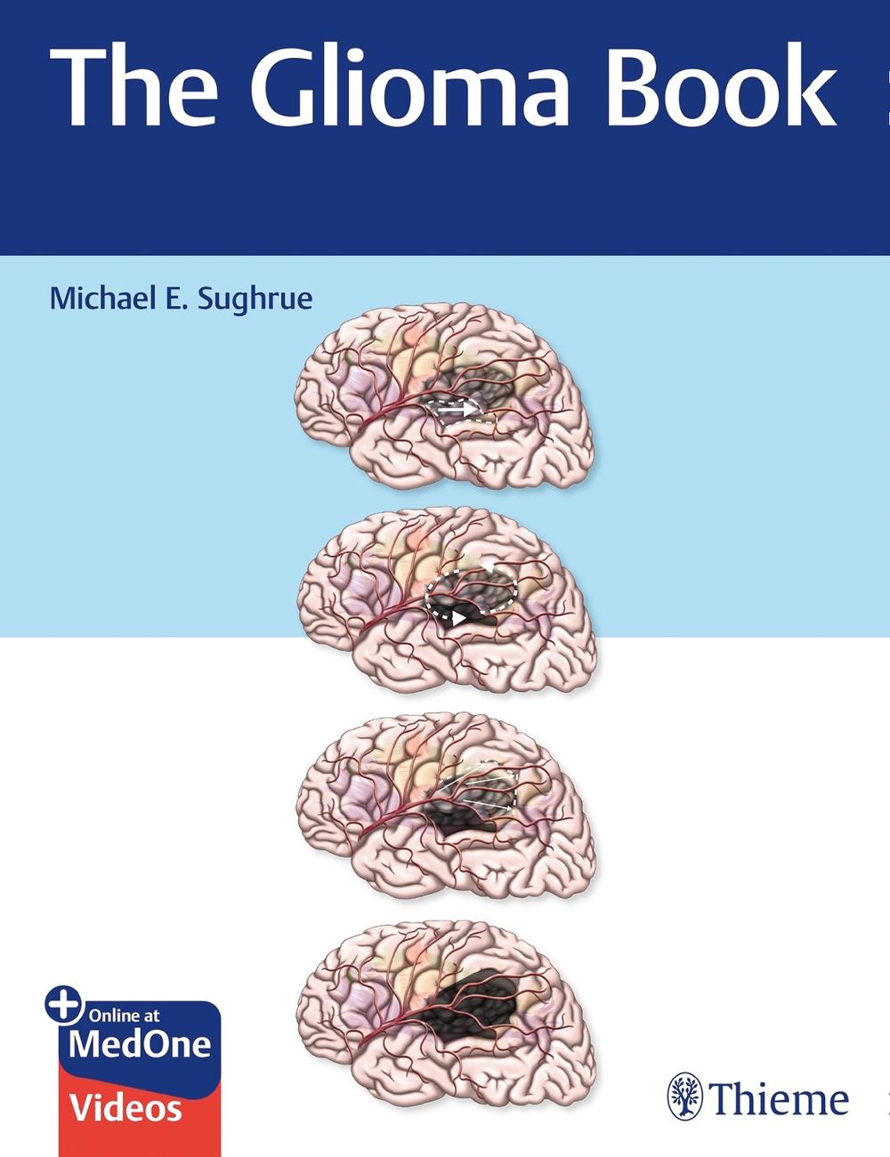 The Glioma Book by Michael E. Sughrue - ISBN: 9781626234444