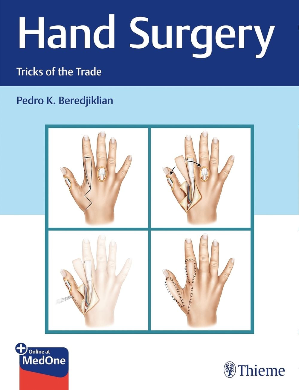 Hand Surgery by Pedro Beredjiklian - ISBN: 9781626234796