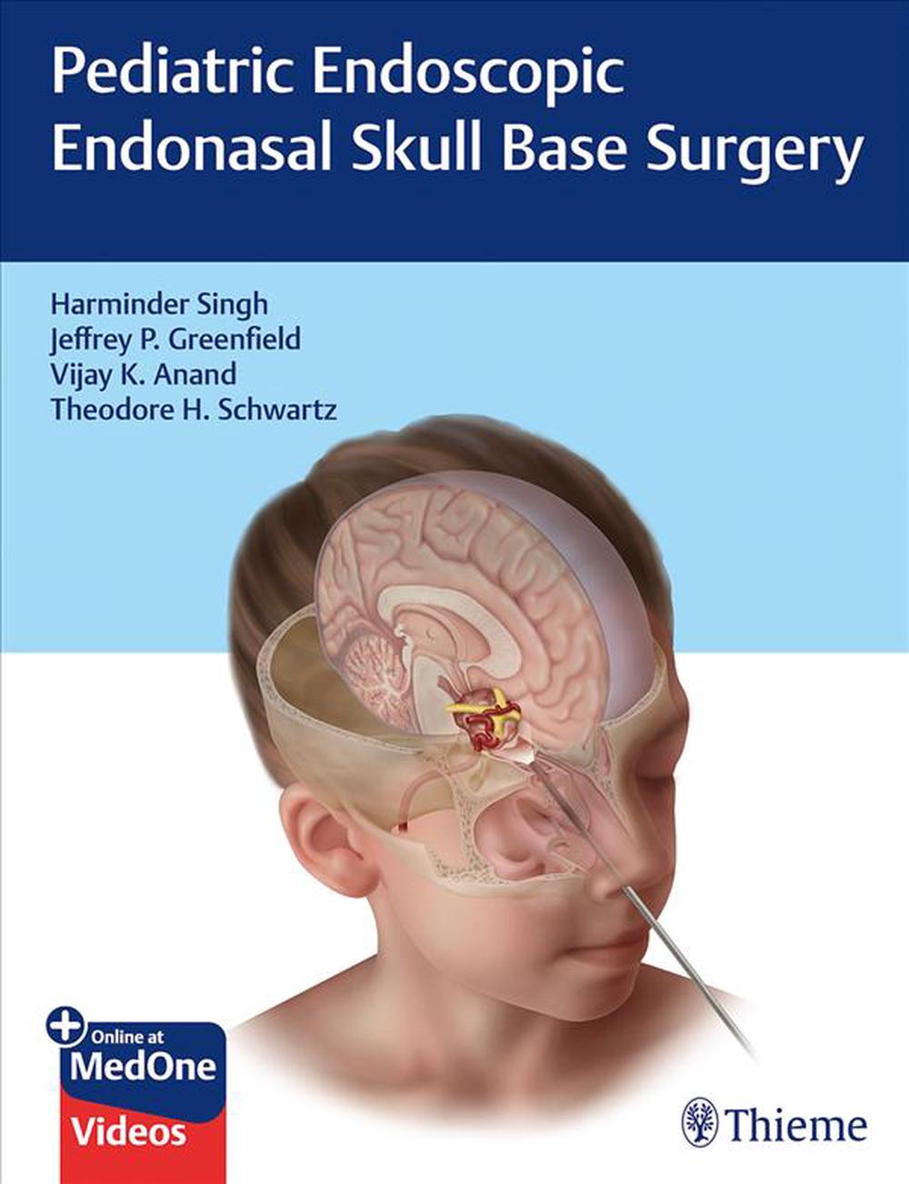 Pediatric Endoscopic Endonasal Skull Base Surgery By Harminder Singh ...