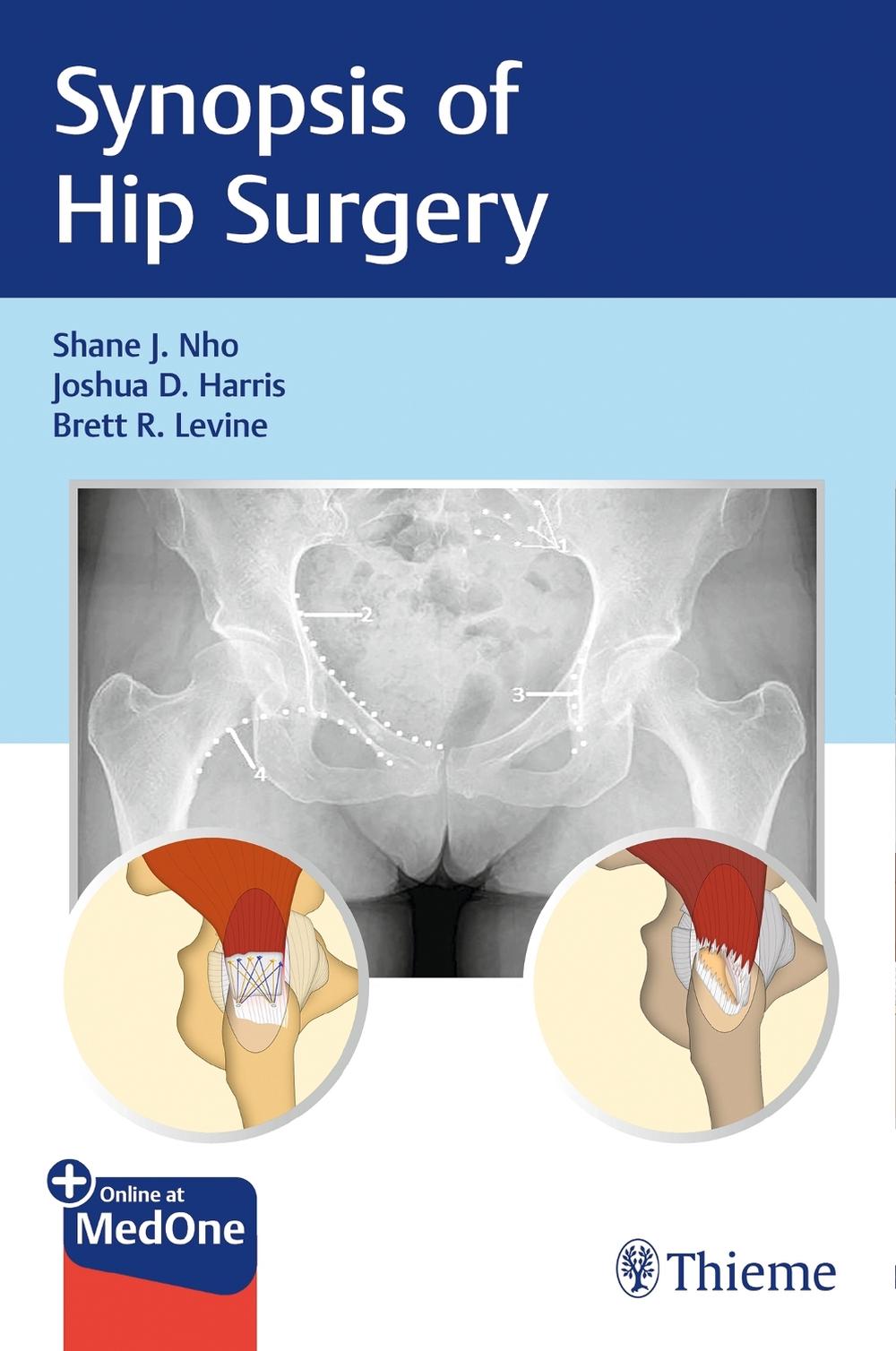 Synopsis of Hip Surgery, 9781626235243