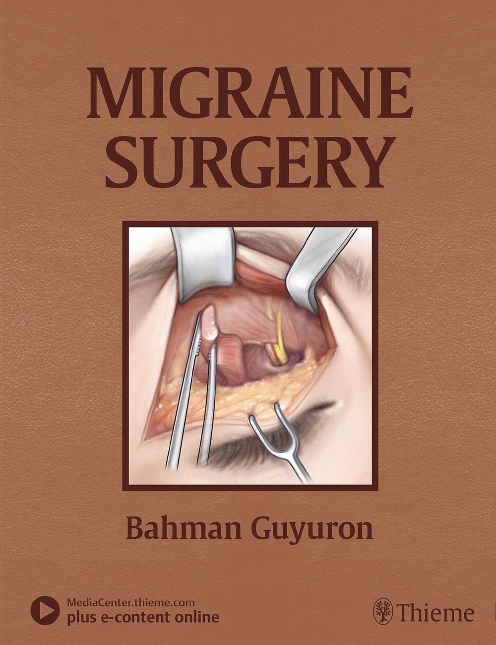 Migraine Surgery by Bahman Guyuron - ISBN: 9781626236929