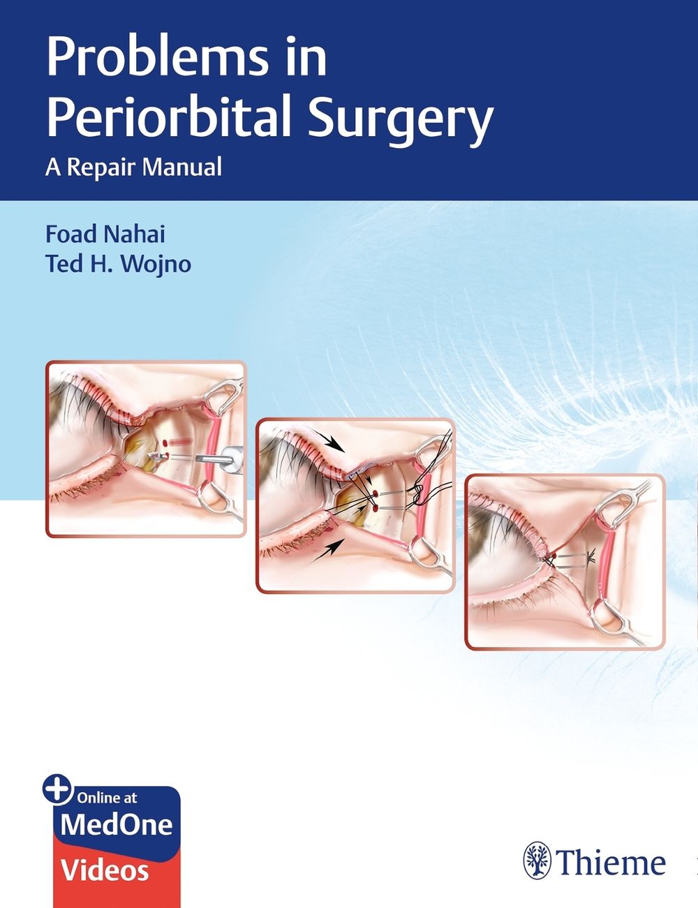 Problems in Periorbital Surgery by Foad Nahai - ISBN: 9781626237087
