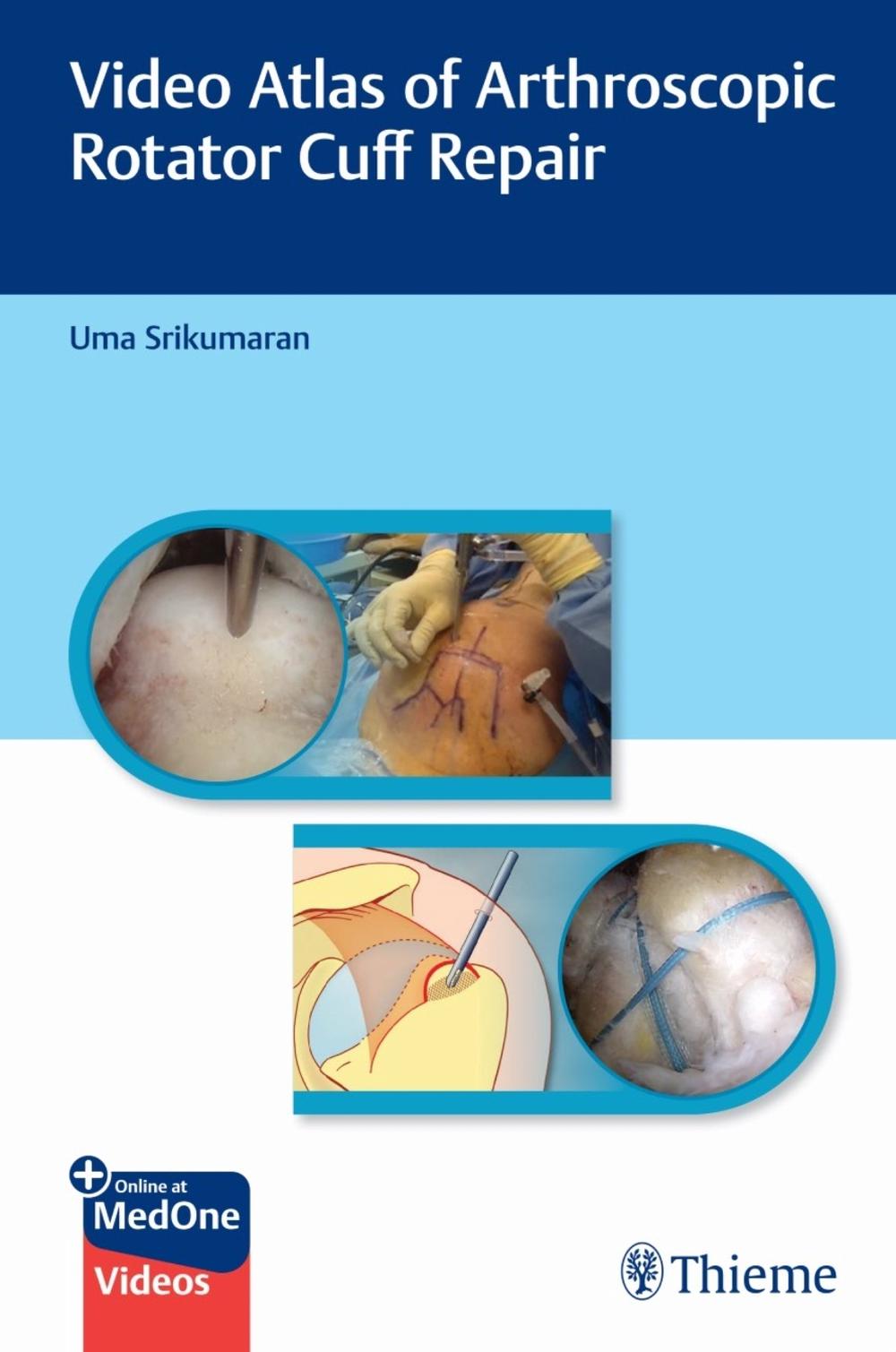 Video Atlas of Arthroscopic Rotator Cuff Repair, 9781626237124