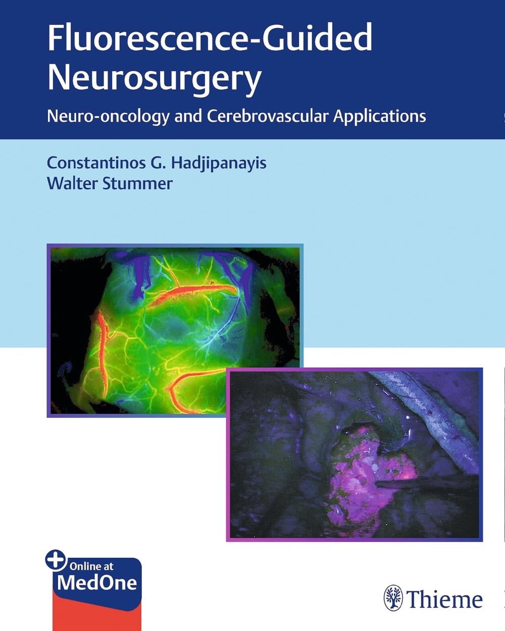 Fluorescence-Guided Neurosurgery by Constantinos G. Hadjipanayis - ISBN: 9781626237148