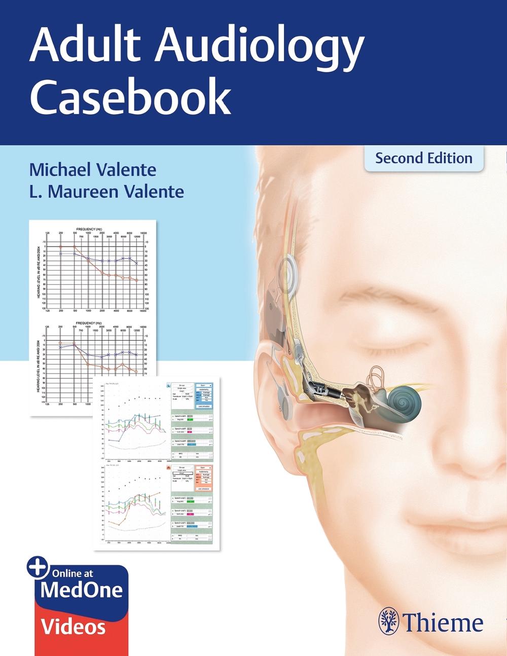 Adult Audiology Casebook, 2nd Edition by Michael Valente - ISBN: 9781626237292