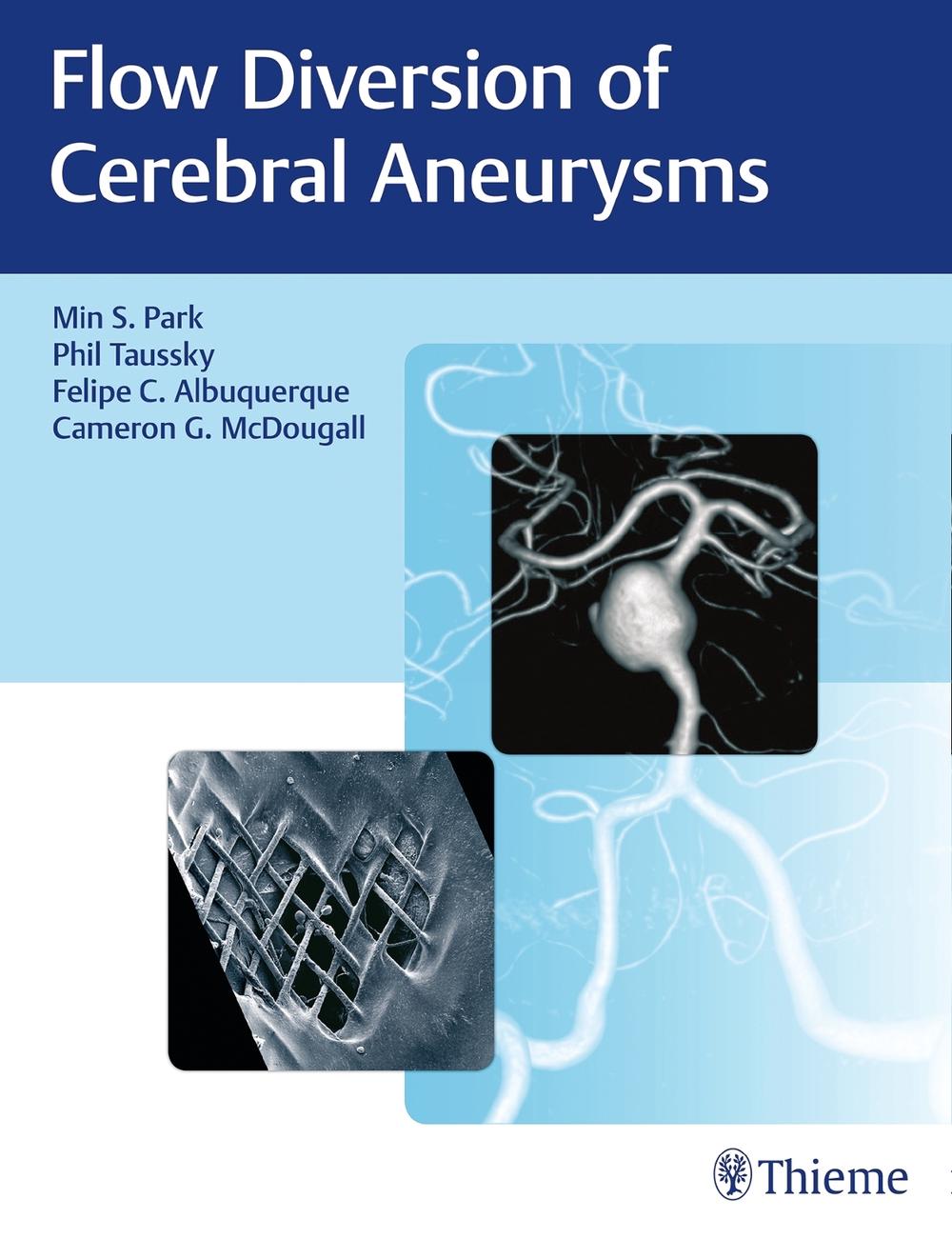 Flow Diversion of Cerebral Aneurysms by Cameron G. McDougall - ISBN: 9781626237773