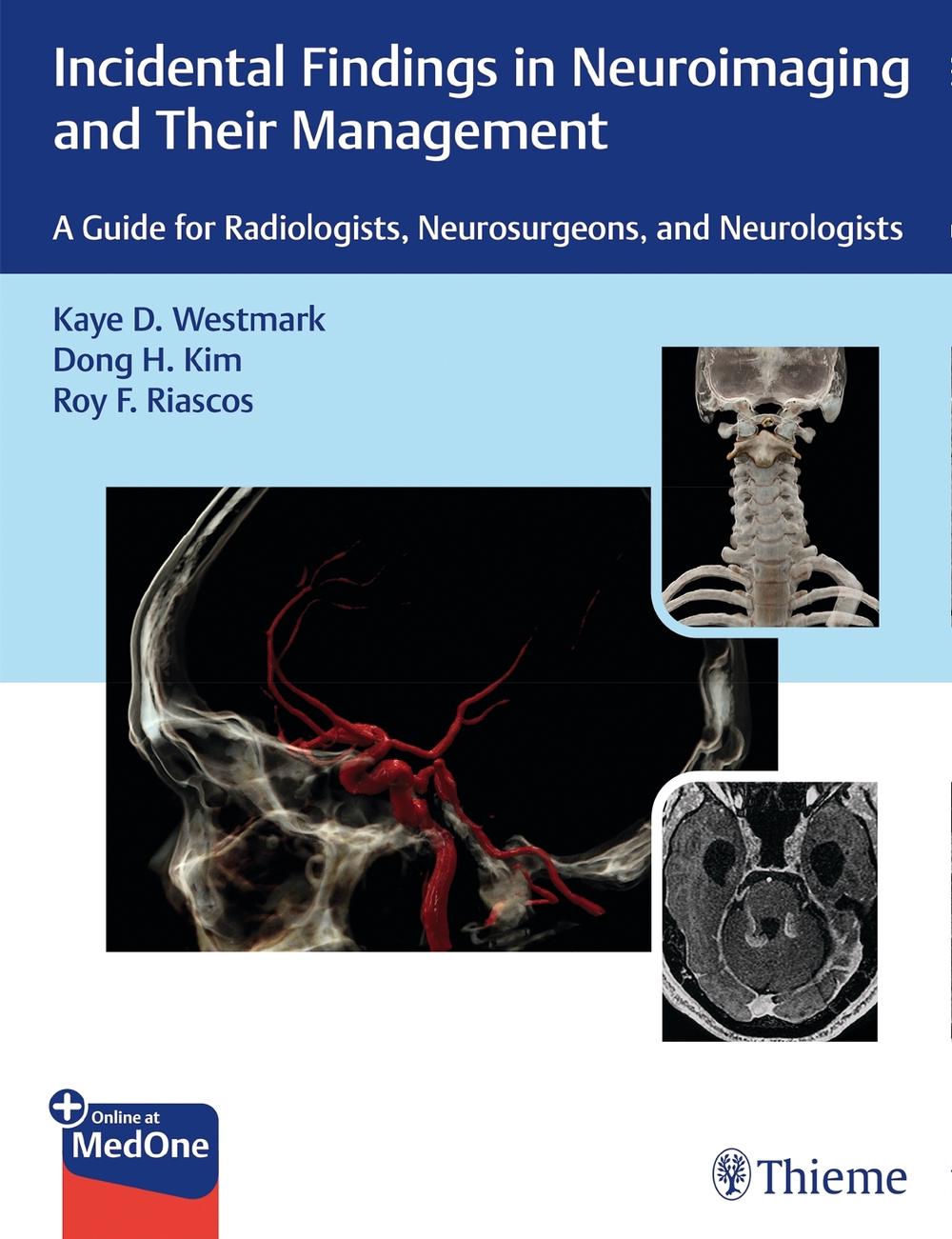 Incidental Findings in Neuroimaging and Their Management by Kaye D. Westmark - ISBN: 9781626238282