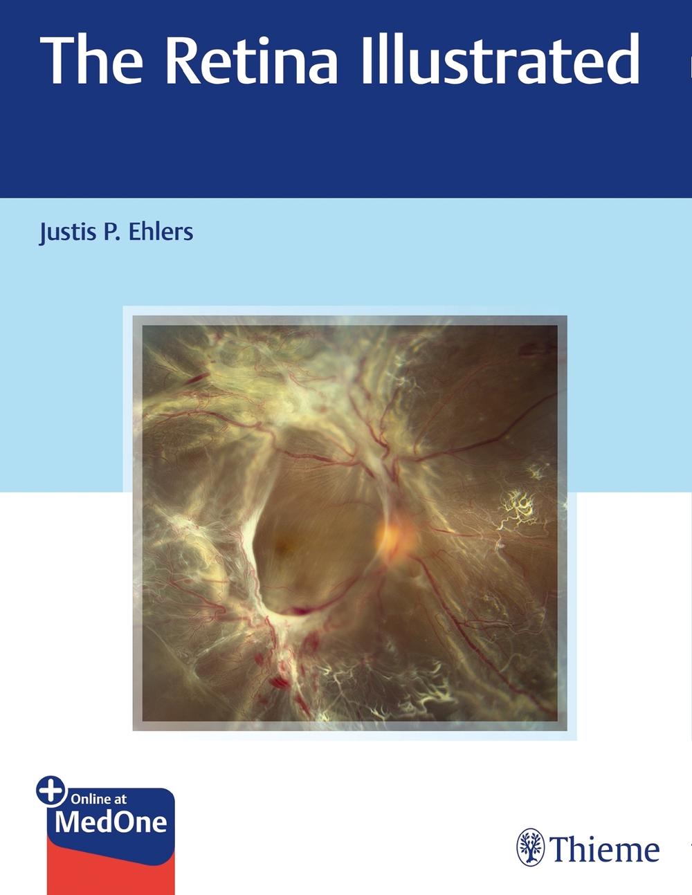 The Retina Illustrated by Justis P. Ehlers - ISBN: 9781626238312