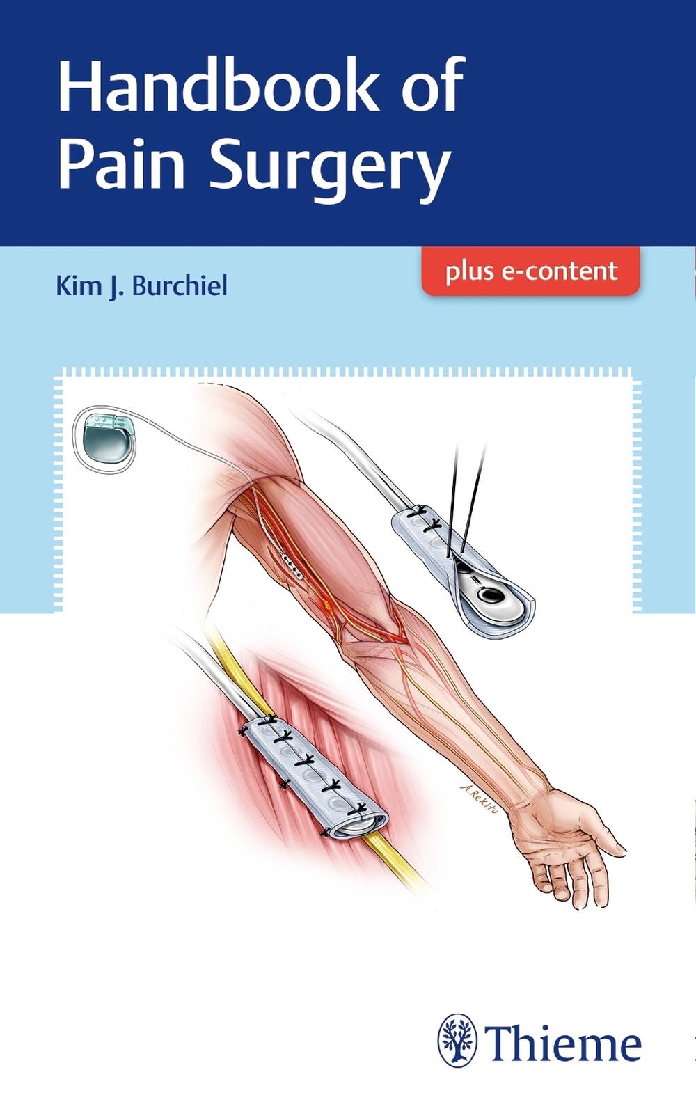 Handbook of Pain Surgery by Kim Burchiel - ISBN: 9781626238718