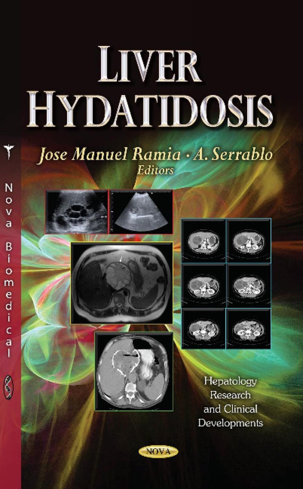 Liver Hydatidosis, 9781628084597