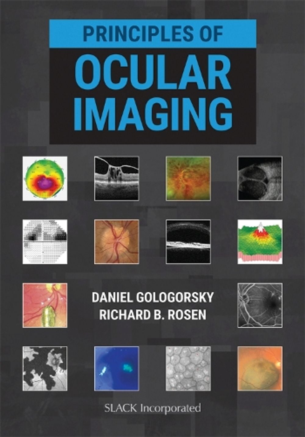 Principles of Ocular Imaging by Daniel Gologorsky - ISBN: 9781630915995