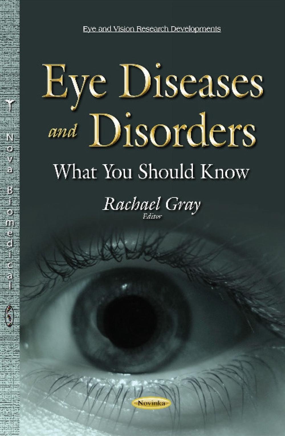 Eye Diseases & Disorders, 9781634638951