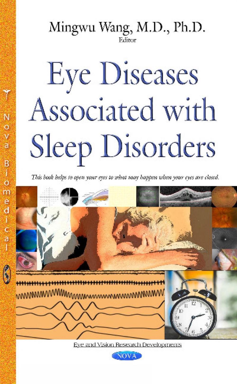 Eye Diseases Associated with Sleep Disorders, 9781634828949