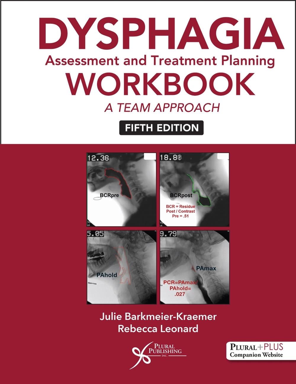Dysphagia Assessment and Treatment Planning Workbook - ISBN: 9781635504965