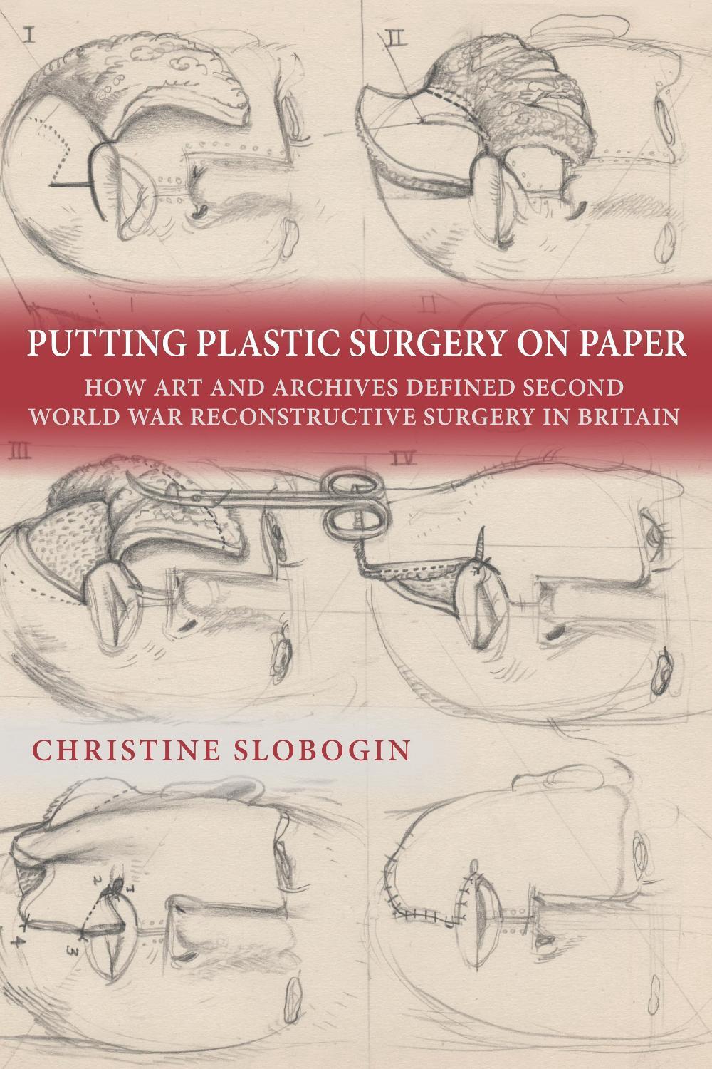 Putting Plastic Surgery on Paper, 9781648251207